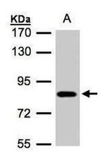 CLC-5 Antibody in Western Blot (WB)