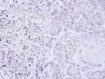ZNF165 Polyclonal Antibody