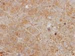 CHI3L2 Polyclonal Antibody