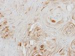 BCAT2 Polyclonal Antibody