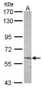 ALAS2 Polyclonal Antibody