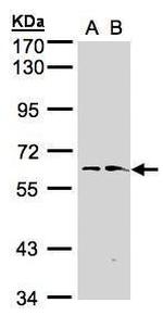 FMO1 Polyclonal Antibody