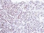 HMBOX1 Antibody in Immunohistochemistry (Paraffin) (IHC (P))
