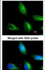 MTMR4 Antibody in Immunocytochemistry (ICC/IF)