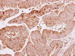MTMR4 Antibody in Immunohistochemistry (Paraffin) (IHC (P))