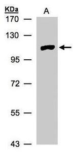 MTMR4 Antibody in Western Blot (WB)