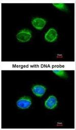 AKR7A2 Polyclonal Antibody