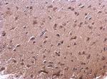 AKR7A2 Antibody in Immunohistochemistry (Paraffin) (IHC (P))