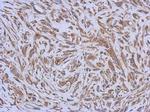 ENTPD3 Polyclonal Antibody