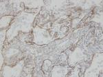 CLIC3 Antibody in Immunohistochemistry (Paraffin) (IHC (P))