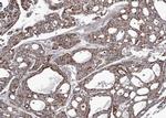 Adenylate Kinase 4 Antibody in Immunohistochemistry (Paraffin) (IHC (P))