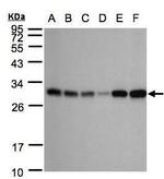 Adenylate Kinase 4 Antibody in Western Blot (WB)