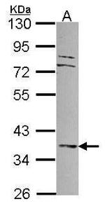 MKP3 Polyclonal Antibody