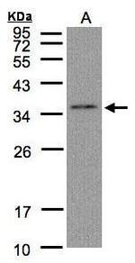 C17orf25 Antibody in Western Blot (WB)