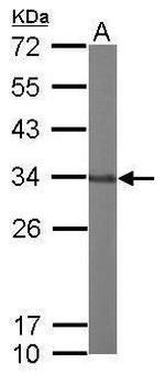 C17orf25 Antibody in Western Blot (WB)
