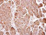TMEM59 Polyclonal Antibody
