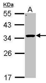 HSD11B1 Antibody in Western Blot (WB)