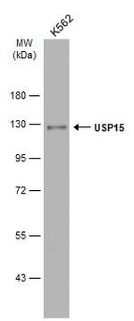 USP15 Antibody in Western Blot (WB)