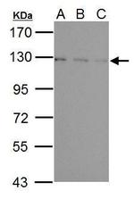 USP15 Antibody in Western Blot (WB)