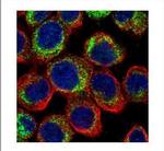 PDE4D Polyclonal Antibody