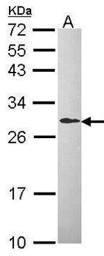 DCXR Polyclonal Antibody
