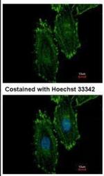 RASGRP4 Polyclonal Antibody