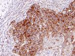 RASGRP4 Antibody in Immunohistochemistry (Paraffin) (IHC (P))