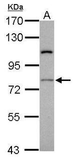 RASGRP4 Antibody in Western Blot (WB)