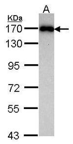 MAGI2 Polyclonal Antibody