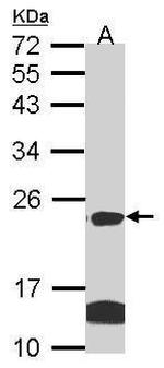 claudin 14 Polyclonal Antibody