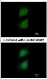PLXND1 Antibody in Immunocytochemistry (ICC/IF)