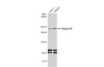 PLXND1 Antibody in Western Blot (WB)