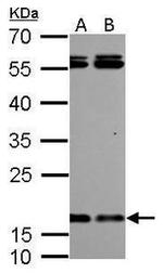 ARF1 Antibody in Western Blot (WB)