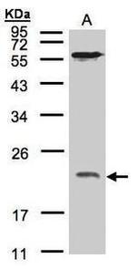 ARF1 Antibody in Western Blot (WB)