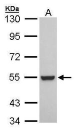 RXRB Antibody in Western Blot (WB)