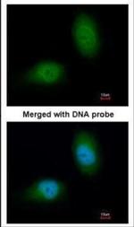 HSPB8 Antibody in Immunocytochemistry (ICC/IF)