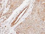HSPB8 Antibody in Immunohistochemistry (Paraffin) (IHC (P))