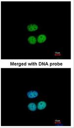 TFE3 Antibody in Immunocytochemistry (ICC/IF)