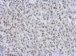 TFE3 Antibody in Immunohistochemistry (IHC)