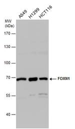 FOXN1 Antibody in Western Blot (WB)
