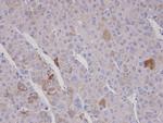 FBXO2 Polyclonal Antibody