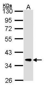 FBXL12 Antibody in Western Blot (WB)