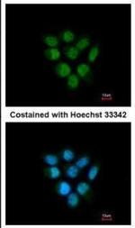 FBXO43 Antibody in Immunocytochemistry (ICC/IF)