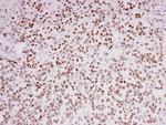 FBXO43 Antibody in Immunohistochemistry (Paraffin) (IHC (P))