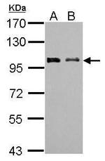 FBXO43 Antibody in Western Blot (WB)