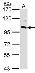 FBXO43 Antibody in Western Blot (WB)