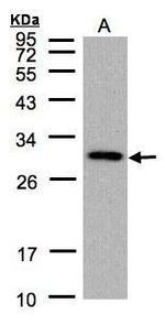 CTDSP2 Polyclonal Antibody