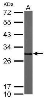 CTDSP2 Antibody in Western Blot (WB)