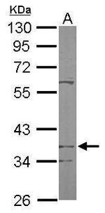 PDSS2 Polyclonal Antibody