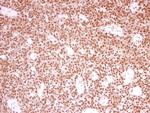 PRPF39 Polyclonal Antibody